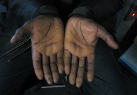 Les mains du djembefola Mar Sanogo
